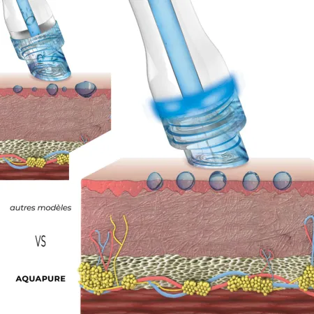 Aquapure I • Proshape - Usage Professionnel - Beauty Tech