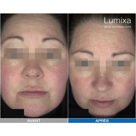 Lumixa • Fb Dermatology