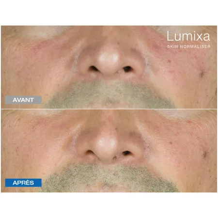 Lumixa • Fb Dermatology