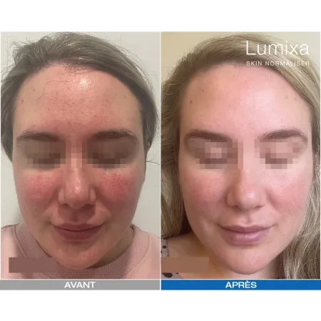 Lumixa • Fb Dermatology