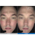 Lumixa • Fb Dermatology