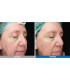 Lumixa • Fb Dermatology