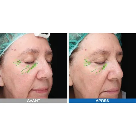 Lumixa • Fb Dermatology