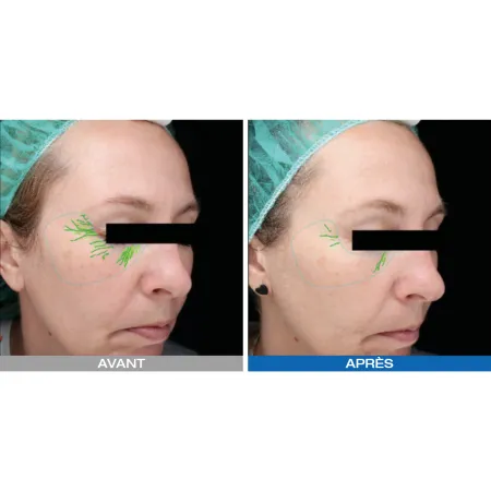 Lumixa • Fb Dermatology