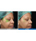 Lumixa • Fb Dermatology