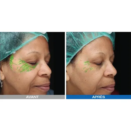 Lumixa • Fb Dermatology