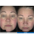 Pack LED Kn7000d X Lumixa • Fb Dermatology X Proshape Action Skin Normaliser