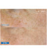 Pack LED Kn7000d X Lumixa • Fb Dermatology X Proshape Action Skin Normaliser