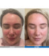 Pack LED Kn7000d X Lumixa • Fb Dermatology X Proshape Action Skin Normaliser
