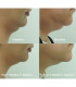 Clatuu Alpha - Appareil minceur professionnel - Beauty Tech