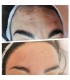 Embouts 1Need Pro x10 - Appareils Minceur et Anti-âge ProShape - Beauty Tech