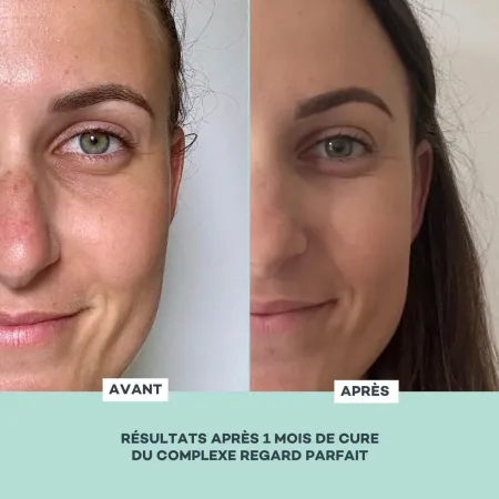 Complexe Regard Parfait • D-Lab - Institut - Beauty Tech