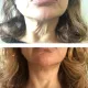 Veloce - Appareils de soin du visage professionnels - Beauty Tech