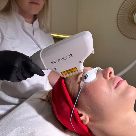Veloce - Appareils de soin du visage professionnels - Beauty Tech
