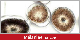 Melanine foncée
